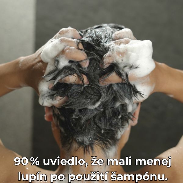 sampon scalp2